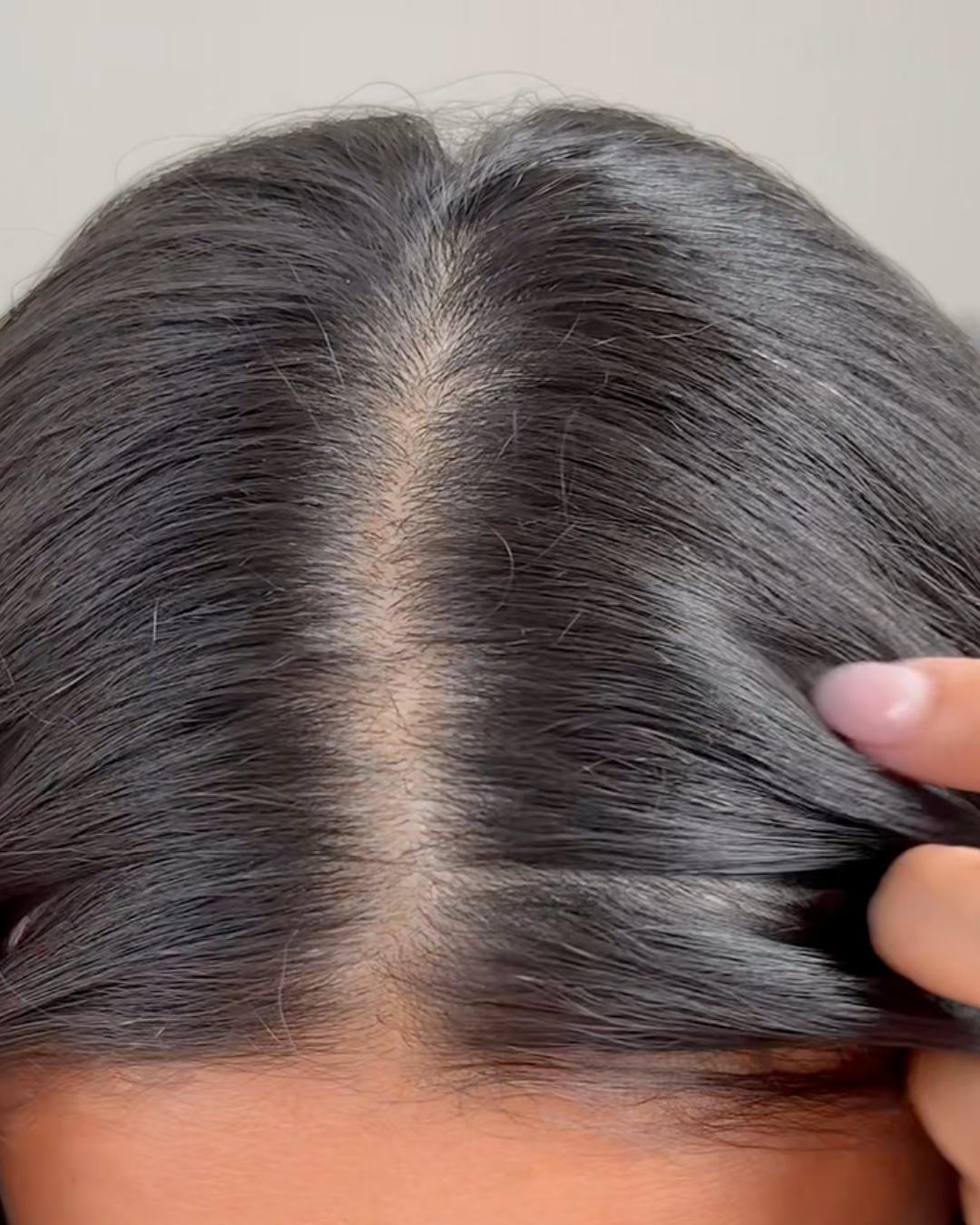 Dry Scalp Relief